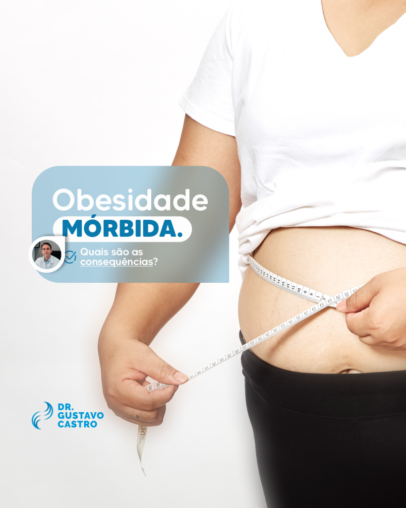Obesidade Mórbida Quais São As Consequências Dr Gustavo Castro 4405